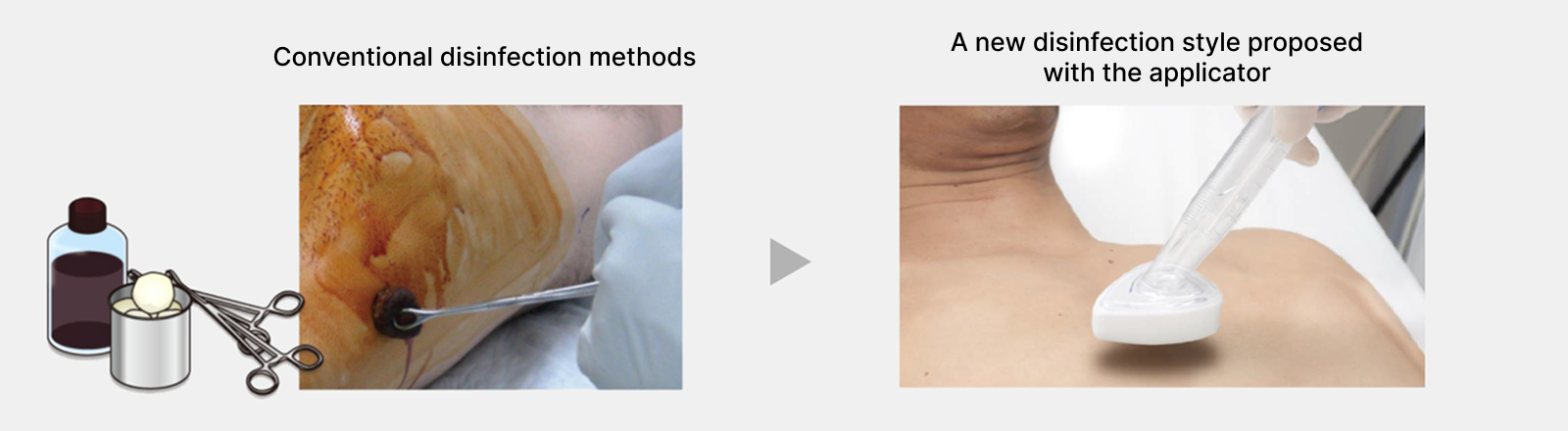 Conventional disinfection methods→A new disinfection style proposed with the applicator