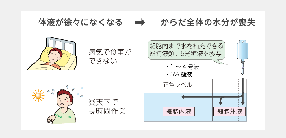 体液が徐々になくなる→からだ全体の水分が喪失する例と維持液類・ブドウ糖液などについて等について