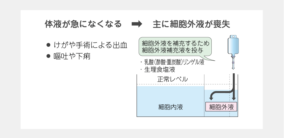 体液が急になくなる→主に細胞外液が喪失した場合に投与される細胞外液補助液について