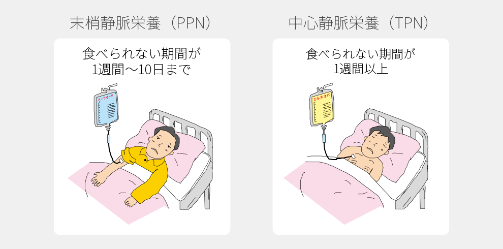 末梢静脈栄養(PPN)食べられない期間が1週間～10日まで。中心静脈栄養(TPN)食べられない期間が1週間以上