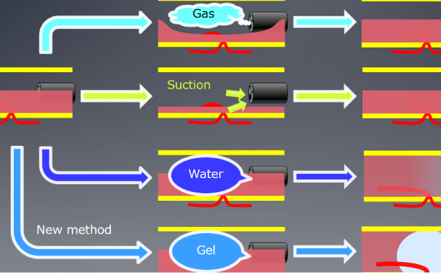 Gel immersion endoscopy