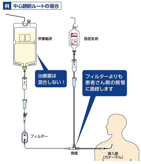 医療用医薬品 医療機器 よくある質問 公式 大塚製薬工場 医療関係者向けページ Otsuka Pharmaceutical Factory Inc