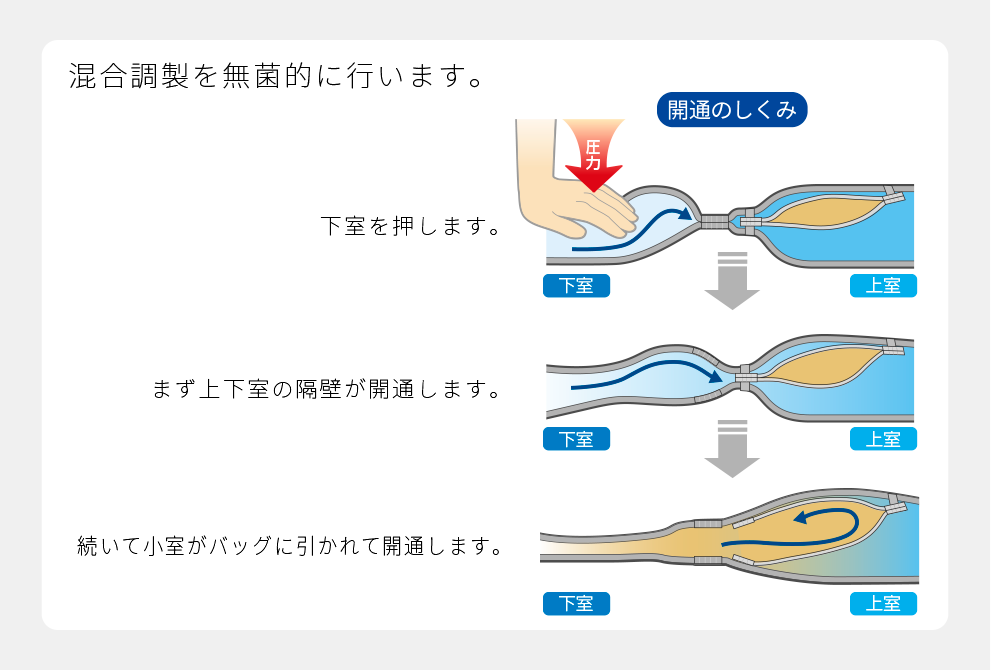 混合調整を無菌的に行います。